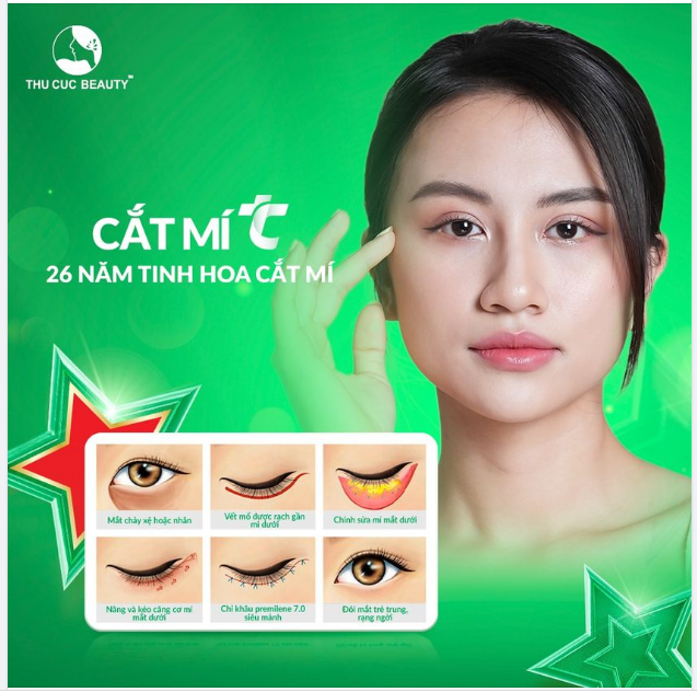 Cắt mí TC - Phương pháp hoàn hảo nhất cho đôi mắt của bạn