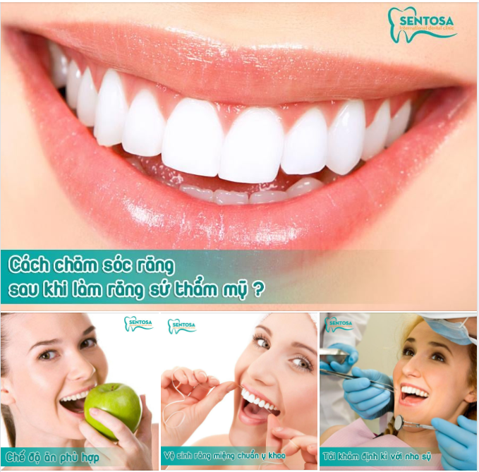 CHĂM SÓC RĂNG MIỆNG SAU LÀM RĂNG SỨ THẨM MỸ NHƯ THẾ NÀO