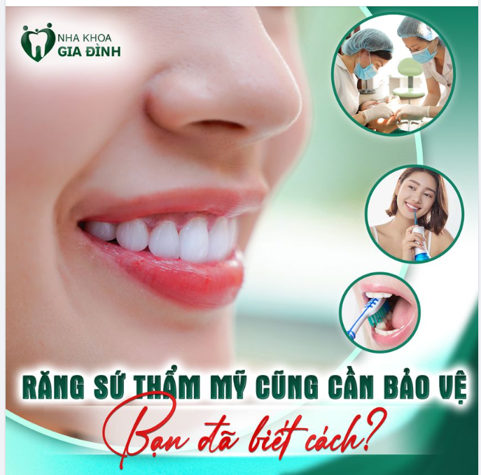 Chăm sóc răng sứ đúng cách thì đừng bỏ qua những chia sẻ dưới đây nhé!