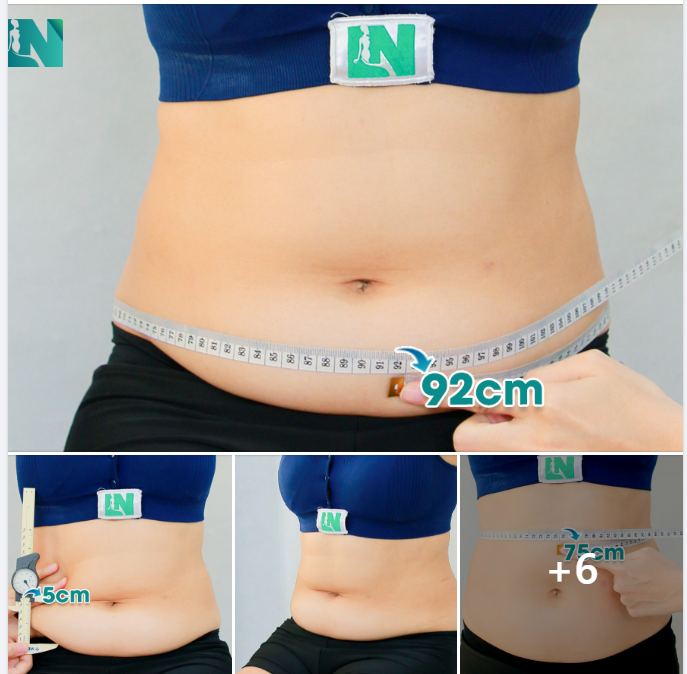 CHỊ KH VIỆT KIỀU (44 TUỔI) – LỰA CHỌN LÀM ĐẸP AN TOÀN TỪ NỬA VÒNG TRÁI ĐẤT. 