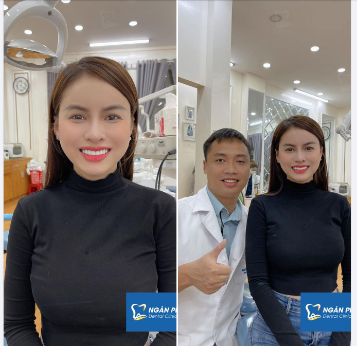 Chìa khóa để sở hữu một nụ cười răng sứ xinh đẹp bền lâu 