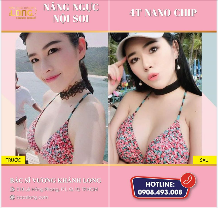 CHO CHỊ ĐẶT 1 CẶP VÒNG 1 “UPSIZE” TĂNG 100% QUYẾN RŨ