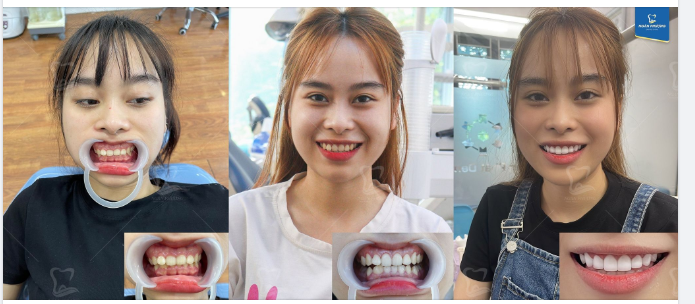 Chớ vội lướt qua mà không chúc mừng cho khách hàng xinh đẹp của Ngân Phượng nhé