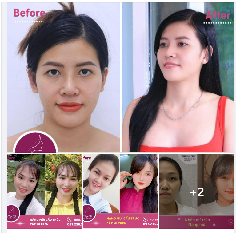CHỌN COMBO, TỰ TIN TỎA SÁNG