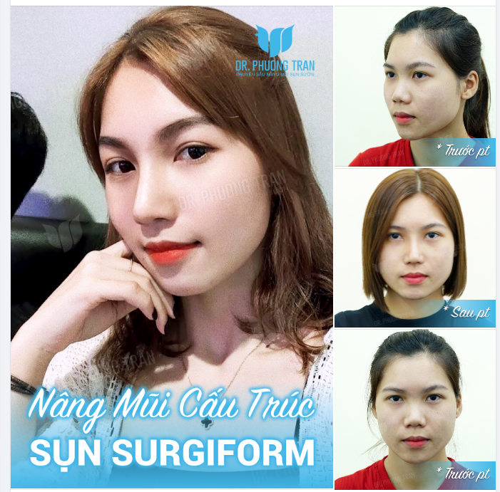 Chú cuội ngồi gốc cây đa. Còn em ngồi trước cổng nhà chờ anh…!
