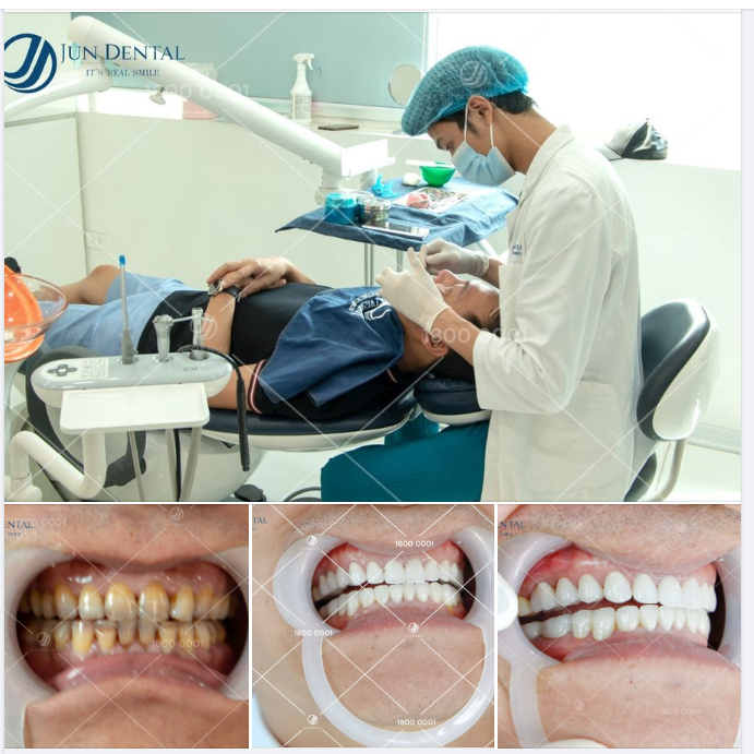 Chúc mừng anh đã lấy lại được vẻ tự tin, chắc hẳn anh sẽ thành công trong mọi việc với một nụ cười tự tin và tỏa nắng!
