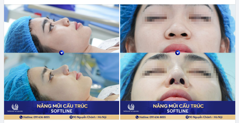 Cô nàng sn 1999 mong muốn có một gương mặt đẹp chuẩn phong thủy, chuẩn xu thế... VÀ CÁI KẾT MỸ MÃN sau 45p
