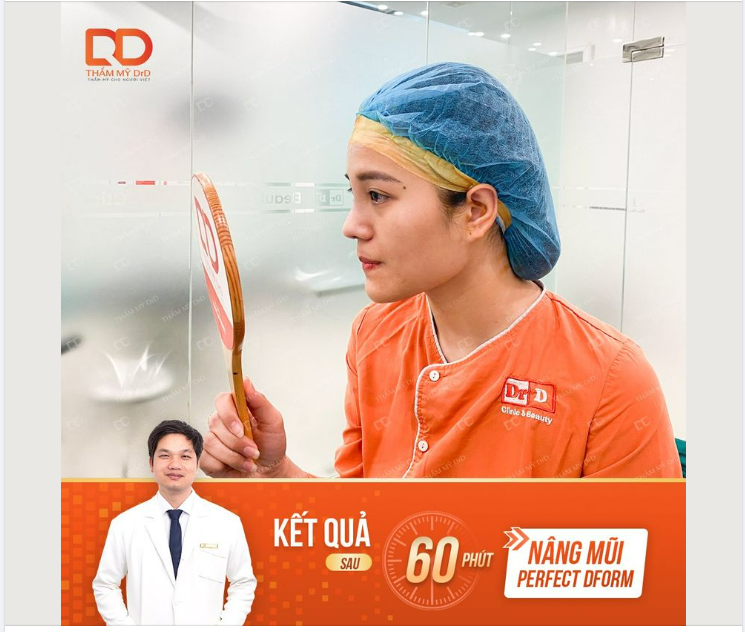 CÓ NGAY DÁNG MŨI MỚI SAU 60 PHÚT PHẪU THUẬT