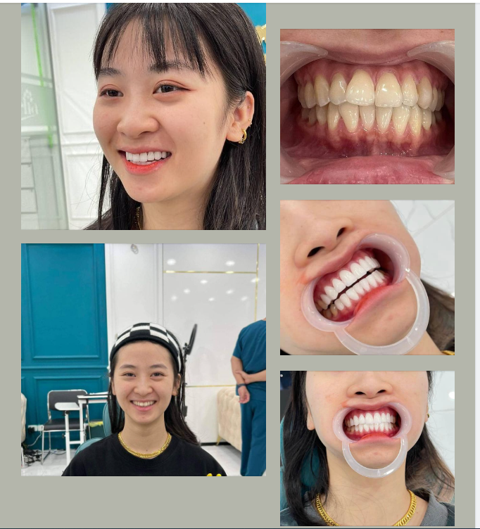  Còn cô gái xinh đẹp này lại quyết định từ Quảng Ninh lên Hà Nội chỉ để gặp bác sĩ Hùng của Delia.