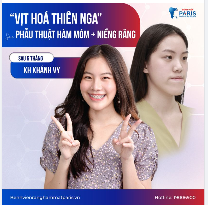 Công thức tạo nên Hot girl, đẹp ngoài mong đợi