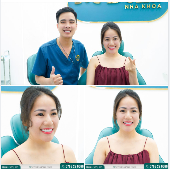 CÙNG NHÌN NGẮM NỤ CƯỜI CHỊ TRANG SAU KHI THẨM MĨ RĂNG SỨ