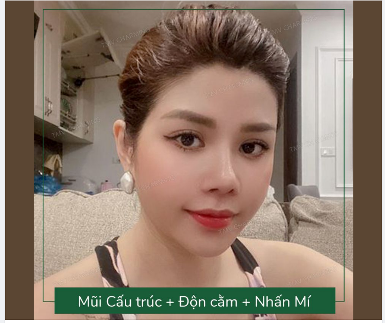Cuộc sống có bao nhiêu năm đâu mà chúng ta phải sống với những thứ mà mình không ưng