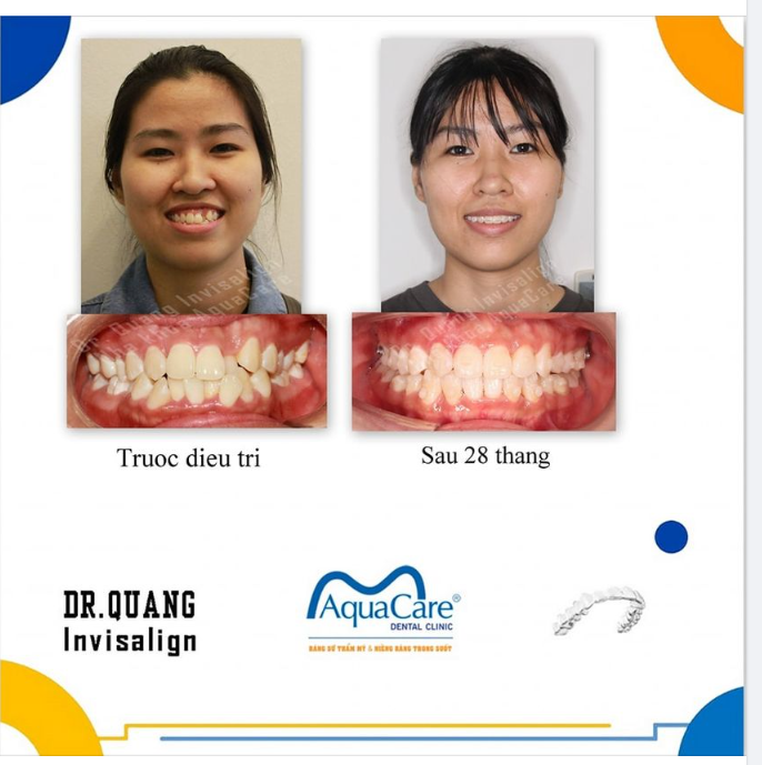 ĐÃ LÀ CÔNG DÂN CỦA MỘT CƯỜNG QUỐC THÌ KHÔNG THỂ ĐỂ RĂNG KHẤP KHỂNH ĐƯỢC