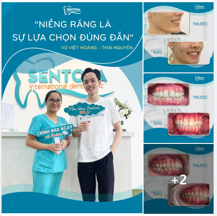 ĐÀN ÔNG CŨNG CẦN PHẢI SỞ HỮU NỤ CƯỜI ĐẸP