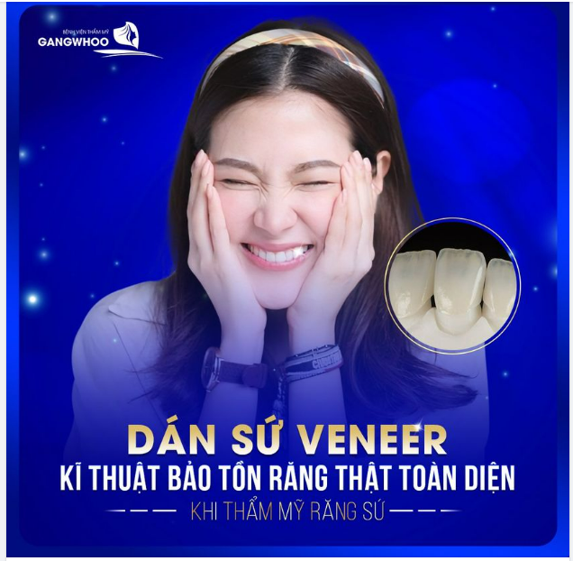 DÁN SỨ VENEER - KĨ THUẬT BẢO TỒN RĂNG THẬT TOÀN DIỆN KHI THẨM MỸ RĂNG SỨ