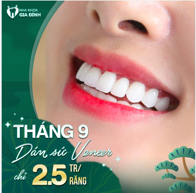 DÁN SỨ VENEER THÁNG 9 CHỈ TỪ 2,5TR/RĂNG
