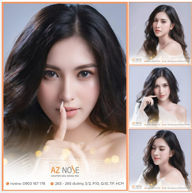 Dáng mũi em 1 năm rưỡi rồi, vẫn đẹp lắm ạ!