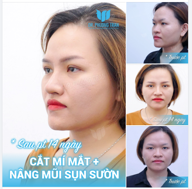Đất nước ta đợi 100 năm độc lập. Em ngại gì vài ngày tháng độc thân...!