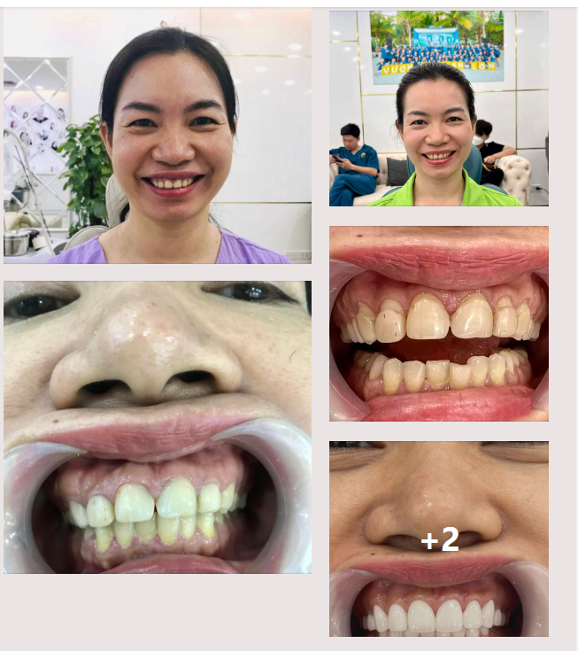 Đến Delia, khách hàng trao niềm tin nhận nụ cười mới trên cả mong đợi!