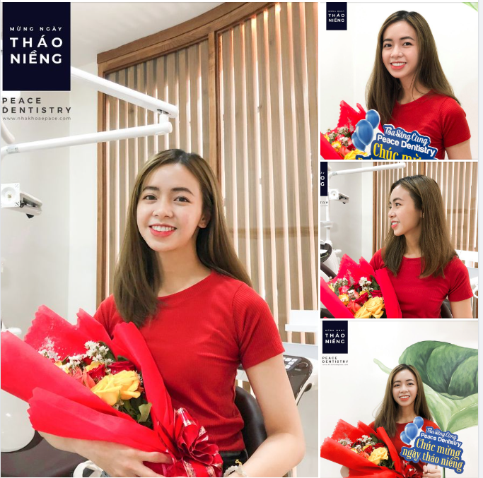 Đến Peace Dentistry – Niềng răng không còn là nỗi lo. An toàn, hiệu quả và thẩm mỹ cao