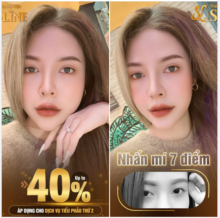 Đẹp lôi cuốn, với đôi mắt 2 mí to tròn.