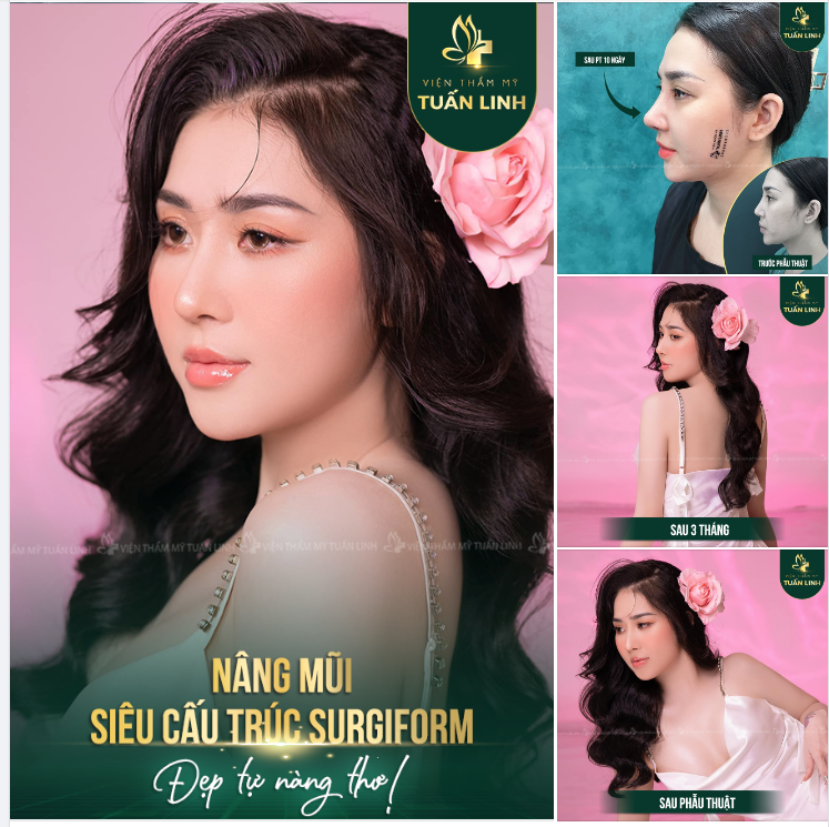 ĐẸP TỰA NÀNG THƠ VỚI DÁNG MŨI CAO XINH - CHỈ TỪ 10TR.