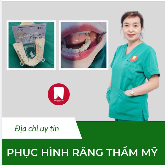 ĐỊA CHỈ UY TÍN - LÀM RĂNG TỰ TIN