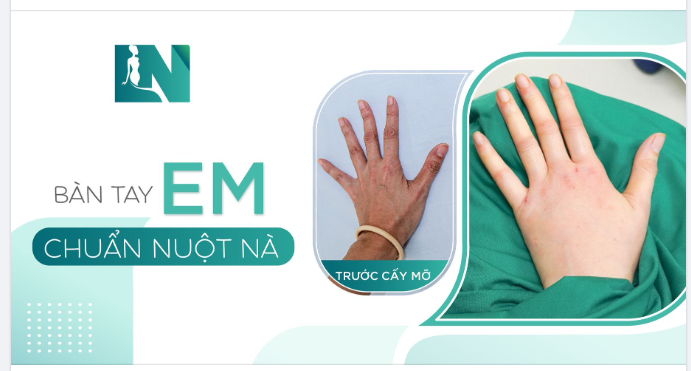 ĐÔI TAY EM THAY ĐỔI THẾ NÀO SAU 45 PHÚT