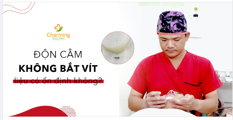 ĐỘN CẰM KHÔNG BẮT VÍT LIỆU CÓ ỔN ĐỊNH KHÔNG