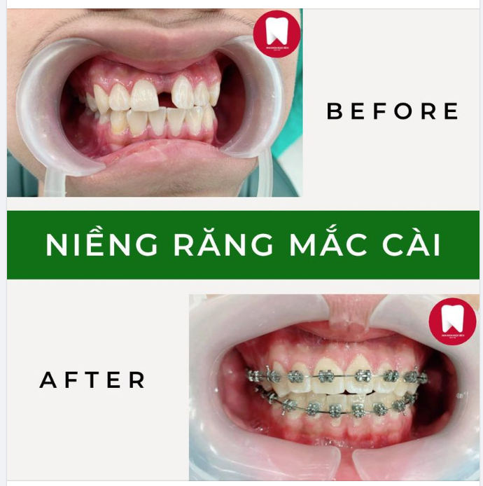 ĐÓNG KHE THƯA, MỞ NỤ CƯỜI MỚI