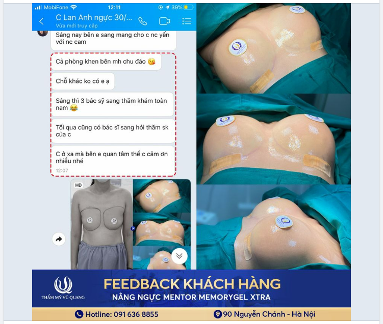 Feedback chất lượng đến từ khách hàng của Thẩm mỹ Vũ Quang.
