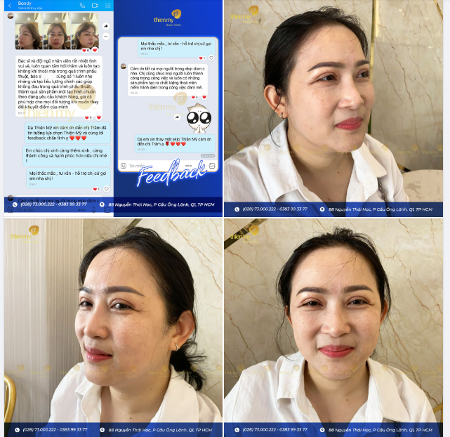 Feedback của khách hàng là động lực để Thiện Mỹ cố gắng từng ngày!!!