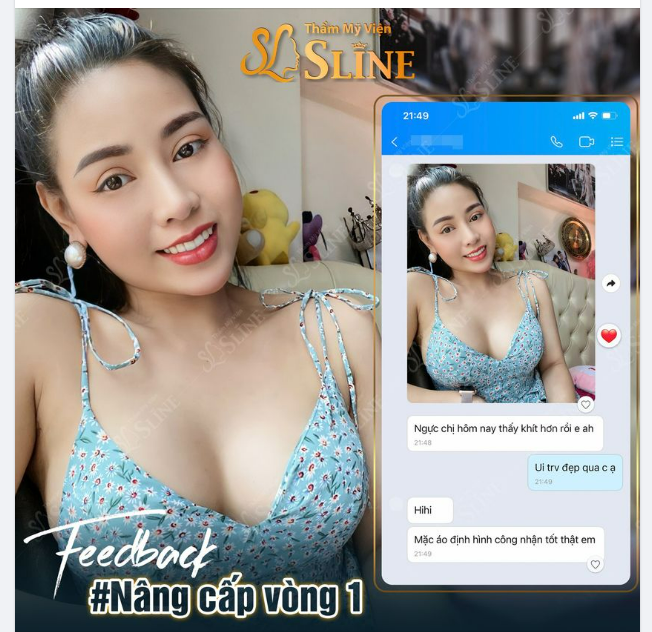 FEEDBACK nâng cấp vòng 1