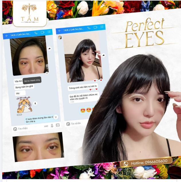 Feedback nóng hổi là phải khoe ngay