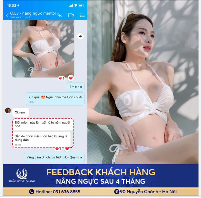Feedback sịn sò dịch vụ nâng ngực Mentor MemoryGel Extra, sau 2 tháng thực hiện đến từ K.H Khánh Ly