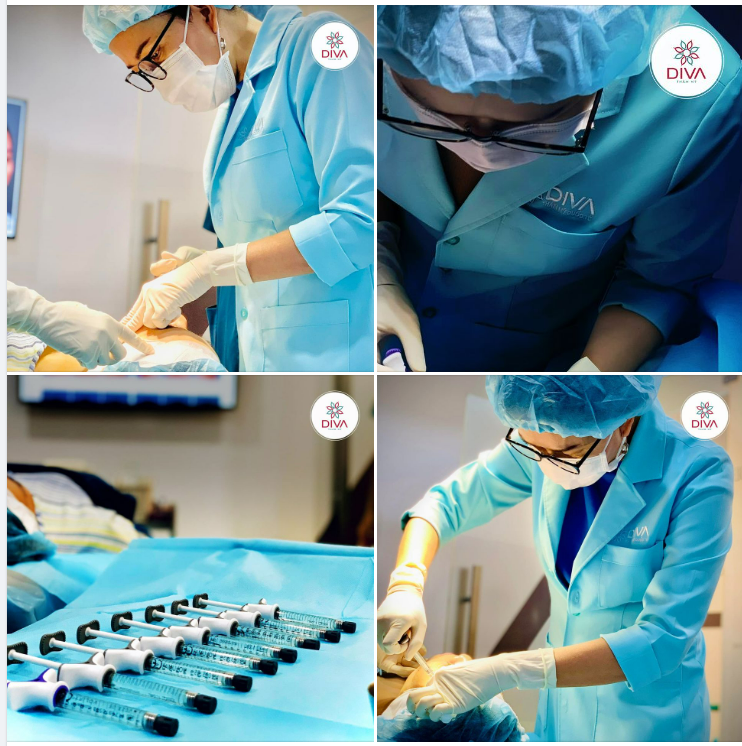 FILLER MD CODES MANG LẠI HIỆU QUẢ CAO TRONG VIỆC ĐIỀU TRỊ CHẢY XỆ KHUÔN MẶT VÌ SAO