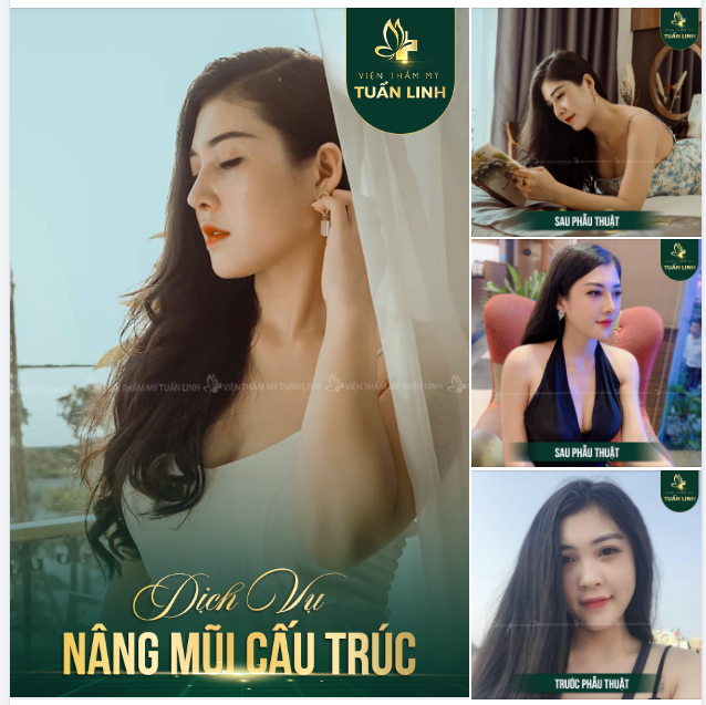 Form mũi như này đủ làm chị em mê mệt chưa