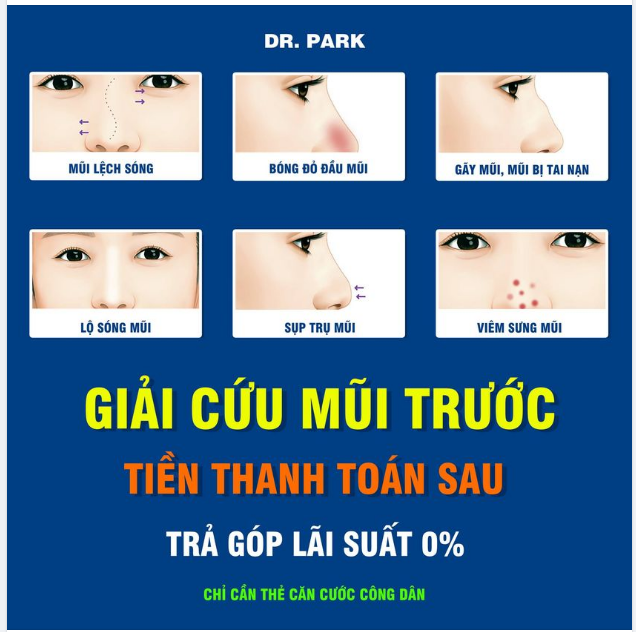 GIẢI CỨU MŨI TRƯỚC - TIỀN THANH TOÁN SAU - LÃI SUẤT 0%