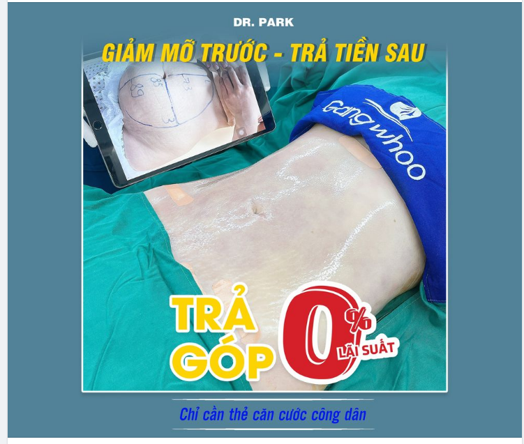 GIẢM MỠ TRƯỚC - TRẢ TIỀN SAU - TRẢ GÓP LÃI SUẤT 0%