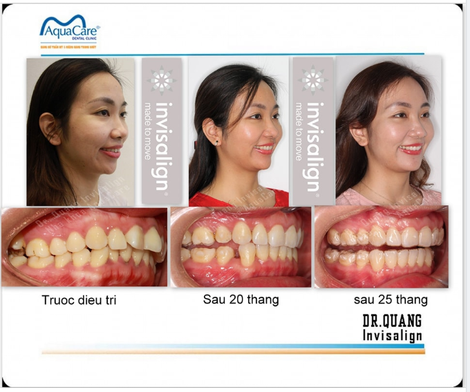 Góc nghiêng này đã đủ để làm bạn siêu lòng chưa