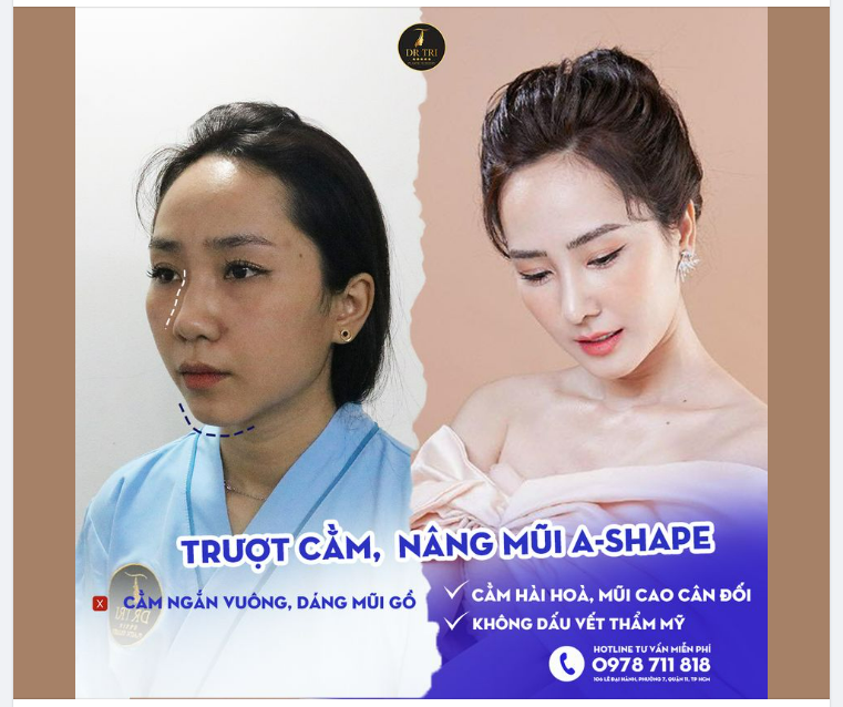 GƯƠNG MẶT ĐẸP KIÊU SA SAU 6 THÁNG THAY ĐỔI DIỆN MẠO