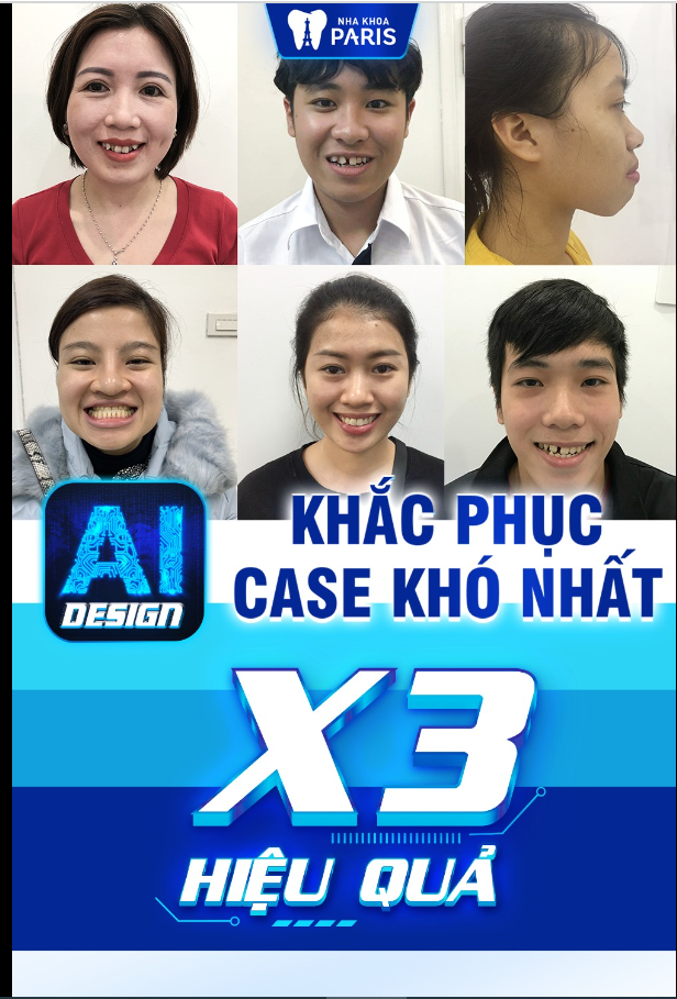 Hệ Thống Mắc Cài Thế Hệ Mới AI DESIGN