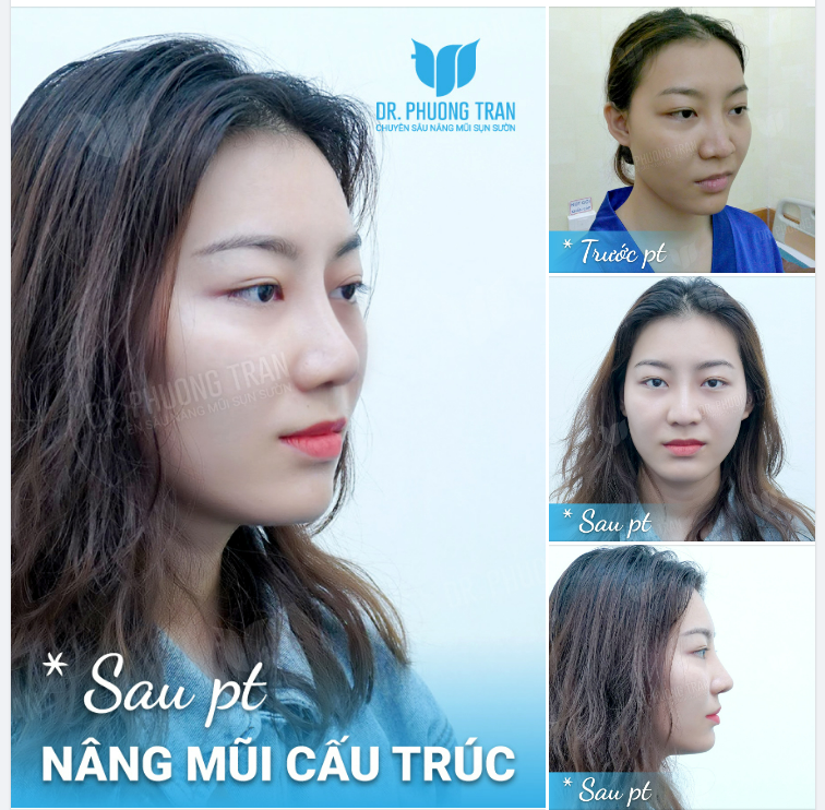 Hoa trên giấy không sương hoa vẫn nở. Thương ai rồi dù trắc trở vẫn thương…!