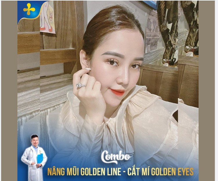 Hoàn thiện đường nét gương mặt với combo nâng mũi Golden Line cắt mí Golden Eyes.