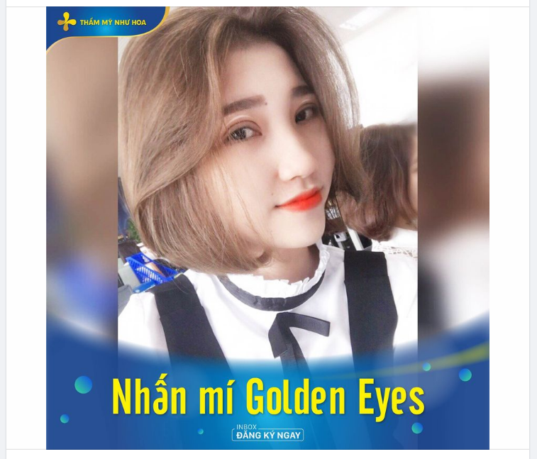 Hoàn thiện khuôn mặt đẹp với dịch vụ nhấn mí Golden Eyes