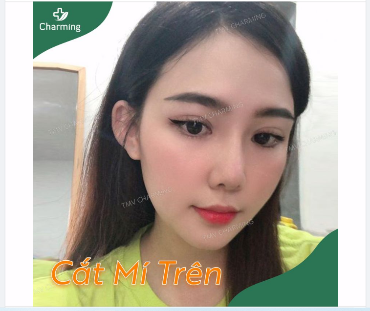 Hồi trước ai bảo em xinh em không chịu đâu, vì mỗi đôi mí trông không ưng ý chút nào.