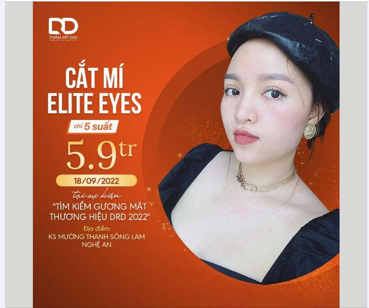 HOT Lâu lắm rồi CẮT MÍ ELITE EYES mới có ƯU ĐÃI nè...