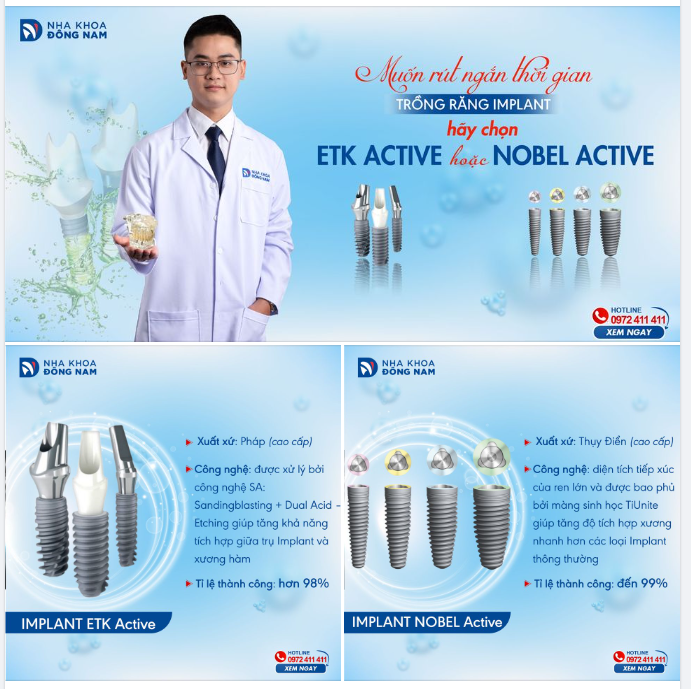 IMPLANT ETK ACTIVE VÀ NOBEL ACTIVE - SỰ LỰA CHỌN HÀNG ĐẦU CỦA VIỆT KIỀU VỀ NƯỚC VÀ BỆNH NHÂN CÓ ÍT THỜI GIAN