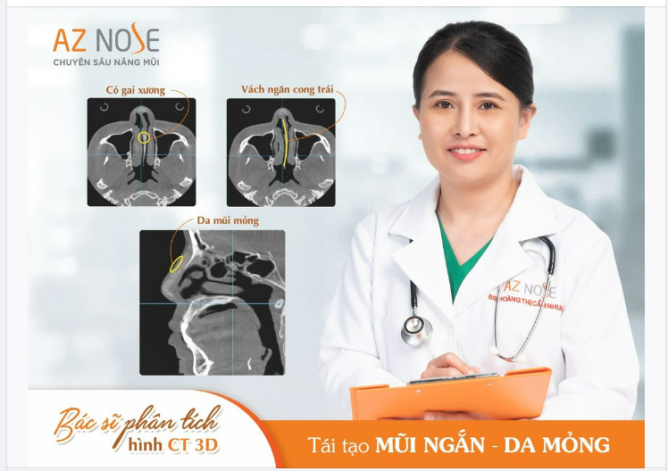 Khắc phục tình trạng mũi ng.ắ.n cho khách hàng 8X