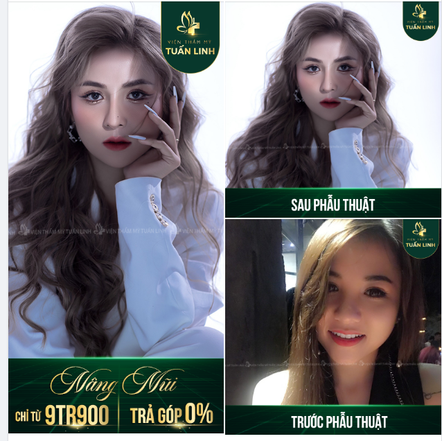  Khách hàng nhà Tuấn Linh hóa hotgirl sang chảnh, hút mọi ánh nhìn với chiếc mũi cao xinh. Xem ngay pic bên dưới để kiểm chứng nhé.